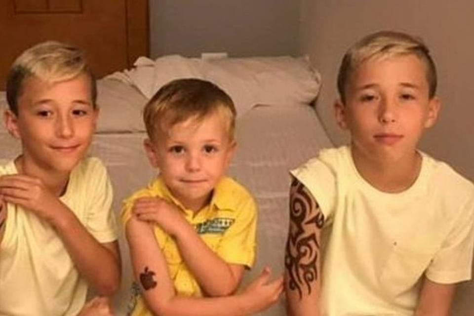 В отеле Хургады дети получили серьёзные ожоги после татуировок хной