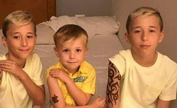 В отеле Хургады дети получили серьёзные ожоги после татуировок хной